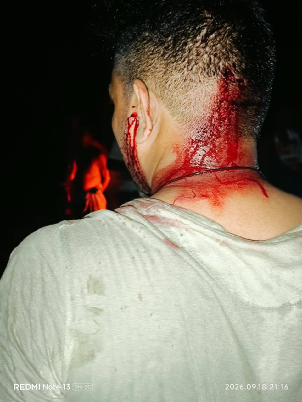 Tourist Injured in Attack by Boatmen at Lotus Marsh